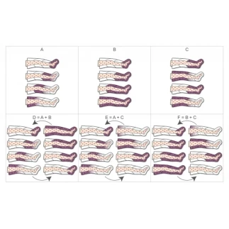 Pressoterapia Mesis PRESSOTERAPIA PRESSOMEDICAL 6.0 ONE ARM