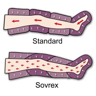 Mesis Pressoterapia Sovrex