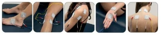Elettrostimolatori I-Tech Mio-Care Tens