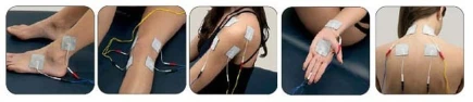 Elettrostimolatori I-Tech Mio-Care Tens