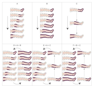 PressoMedical 6.0 FOUR4 - Pressoterapia professionale con 7 dotazioni